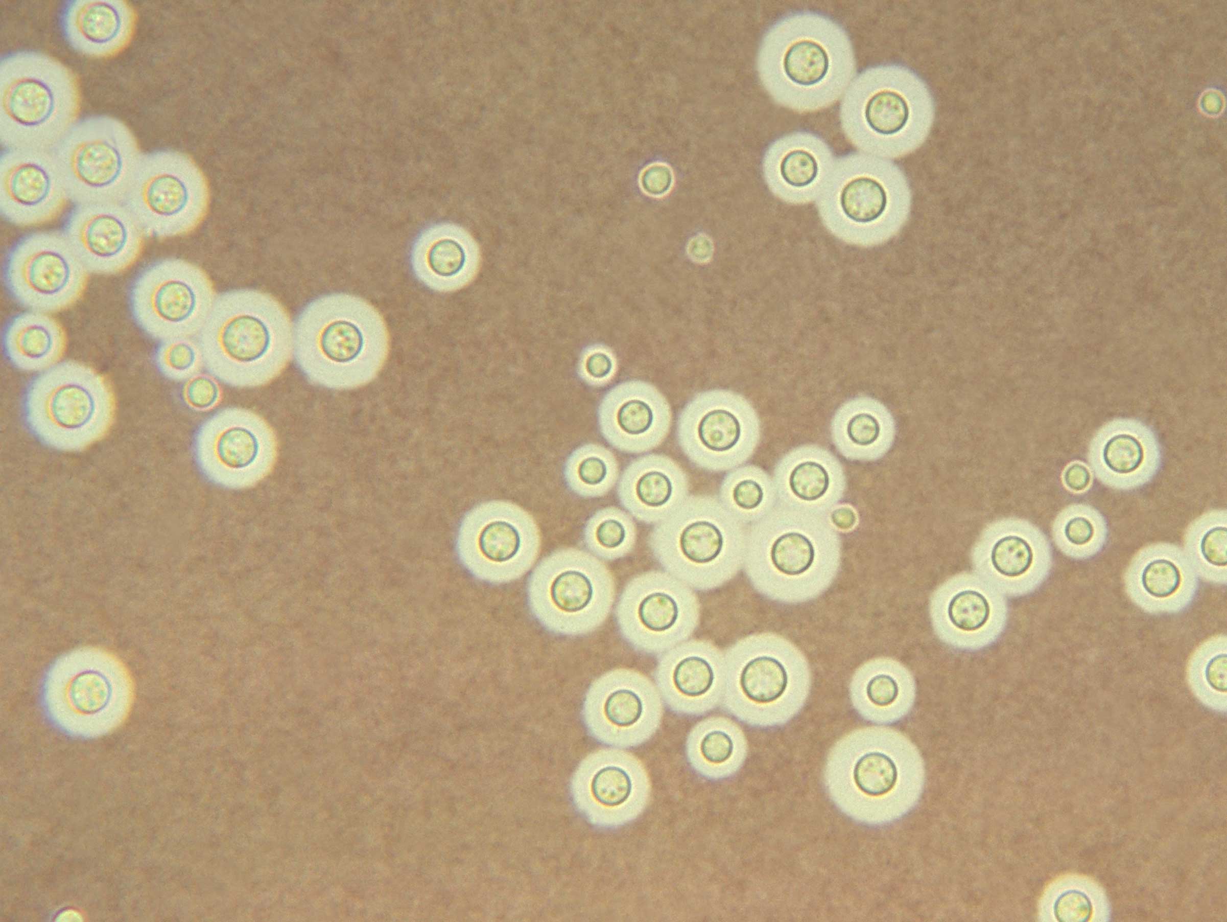 States, Societies, and the Control of Contagion in China and India